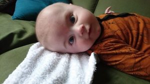torticollis scheefhals foto 2