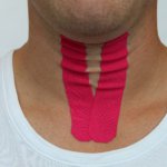 logopedie sternohyoideus stem - FysioTape