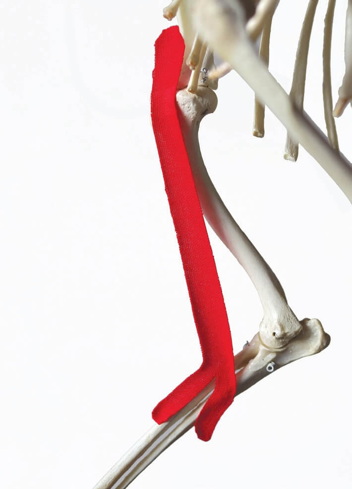 Y-vormige tape gepositioneerd langs de biceps brachii, getoond op een skelet