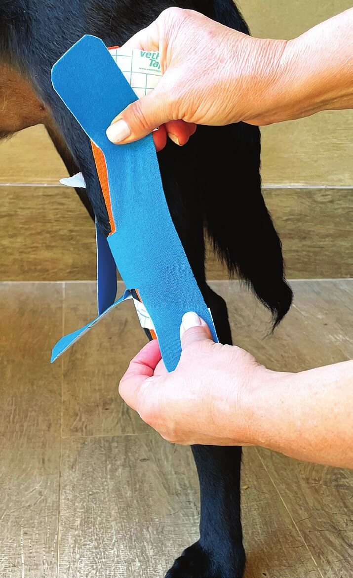 Een tweede versterkende H-tape aanbrengen, laterale weergave