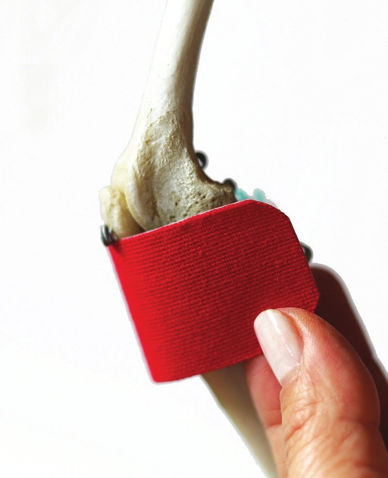 Positie van de tape over de patellapees, getoond op een skelet