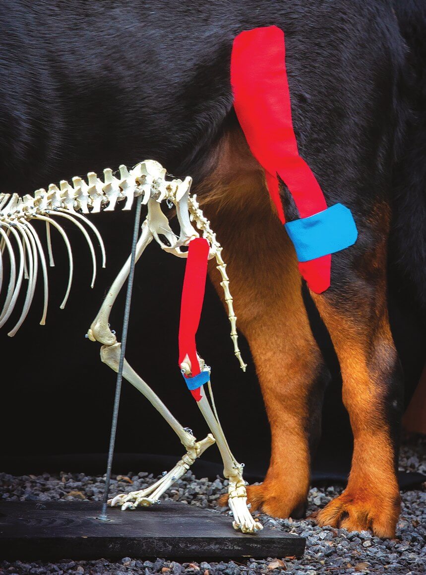 Y-vormige tape aangebracht ter facilitatie van de quadricepsspier voor patellaondersteuning